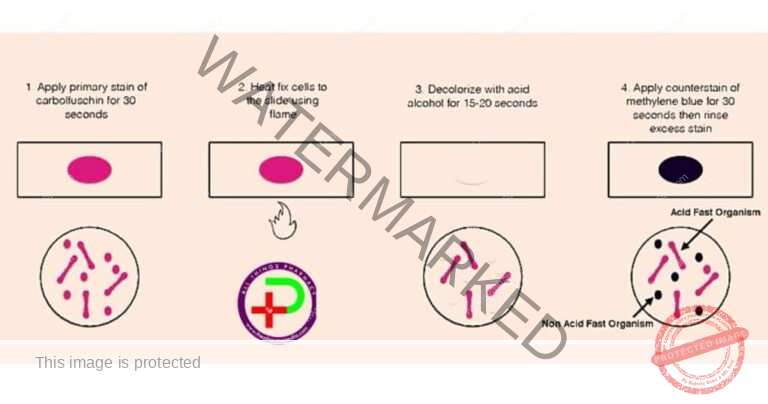 Differential Staining: Gram Staining & Acid-fast Staining Technique ...